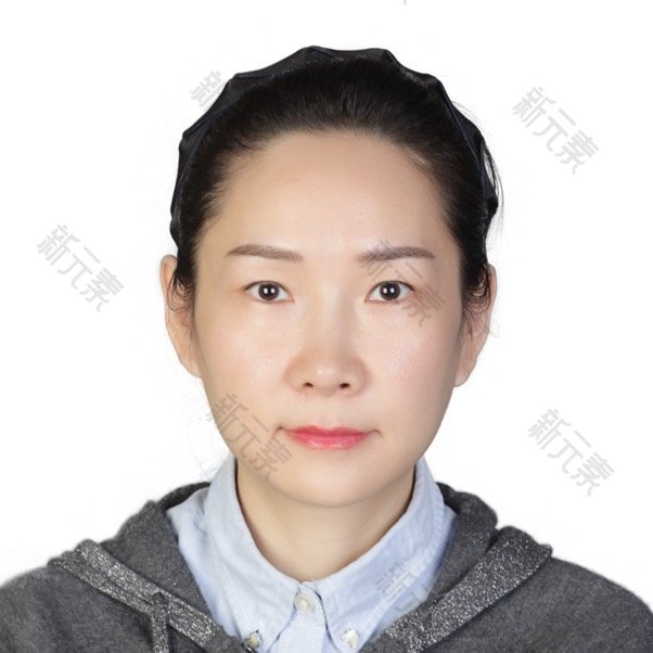 武汉爱尔眼科医院汉口医院杜薇