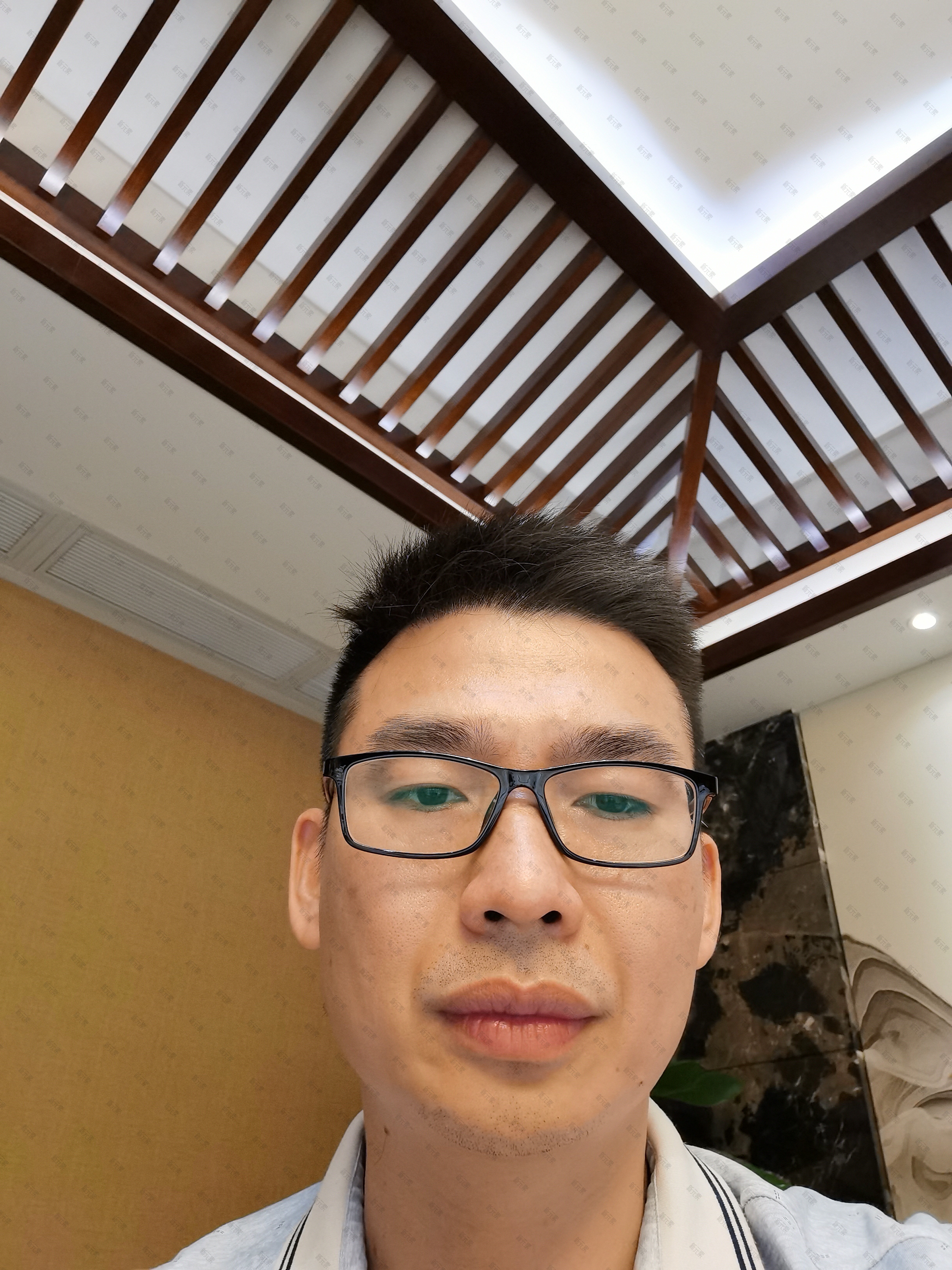 新氧医生咨询团刘伟源