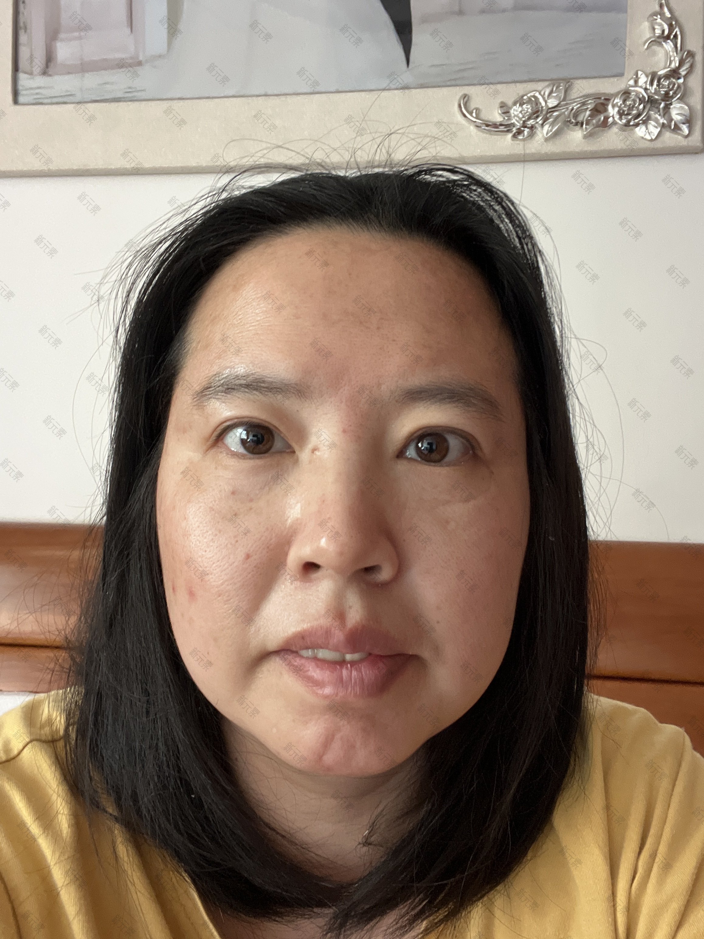 上海华美医疗美容医院唐晓芬